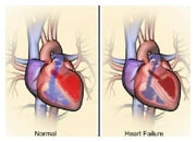 How the heart and body compensate in heart failure