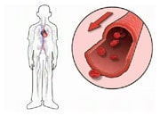How vasodilators work in heart failure